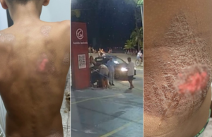 Motorista de carro de luxo atropela criança de 12 na faixa de pedestre no litoral SP