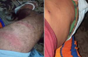 Empresário é agredido por guardas a caminho de casa em SP