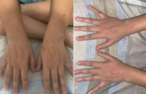 “Em estado de choque” Estudante é agredido na saída de escola no litoral de SP