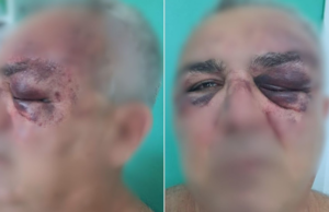 Aposentado é agredido por vizinho ao receber encomenda no litoral de SP