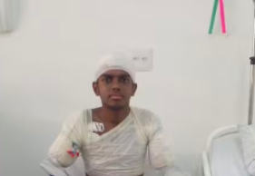 Adolescente amputou braços, pernas e parte de pé após levar choque.