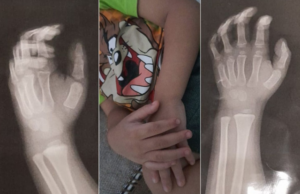 Professora agride criança de 3 anos em creche de Guarujá e é demitida