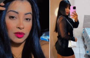 Mulher morre após procedimento estético em São Vicente.