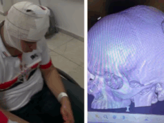 Torcedor é atingido por placa de metal no estádio do Morumbi.