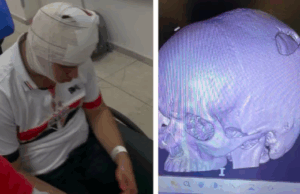 Torcedor é atingido por placa de metal no estádio do Morumbi.