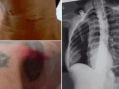 Mulher se joga da moto após ser atingida por linha com cerol.